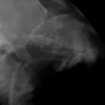 Deutlich ist die Frakturstelle auf dem Röntgenbild zu erkennen. Katze Kieferfraktur gebrochener Kiefer Kieferbruecke 1